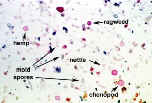 mold sample from under a microscope